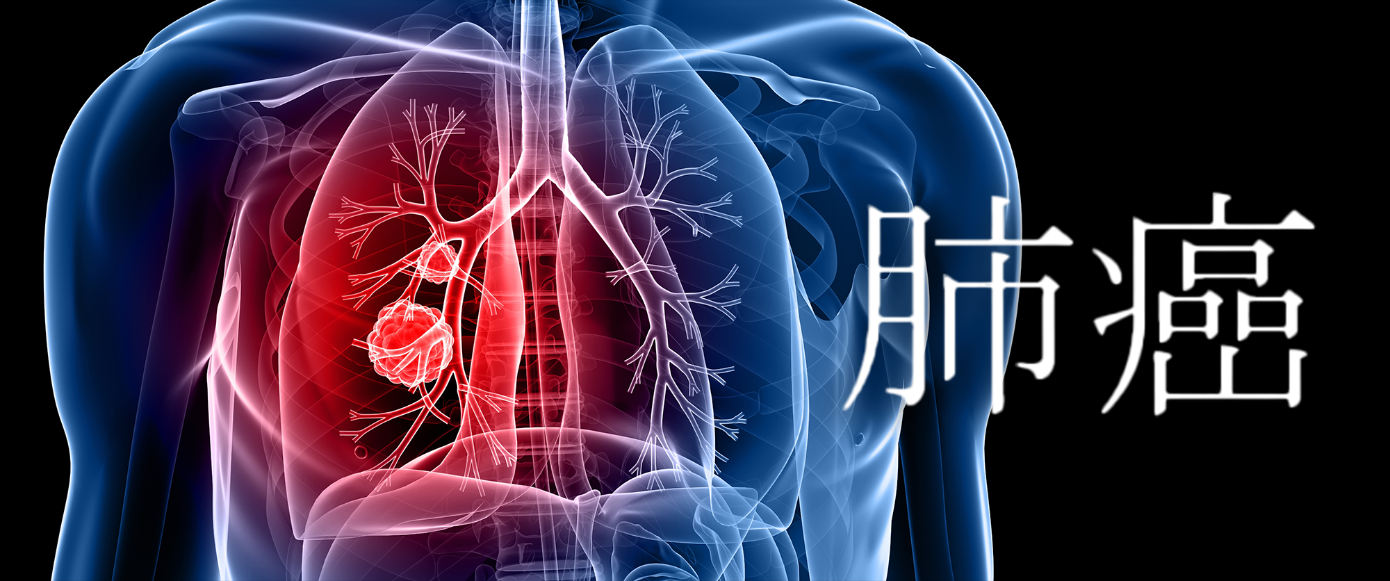 Lung Cancer and Lung Cancer Screening webinar (Cantonese)