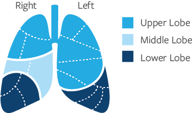 Lung Lobes and Segments